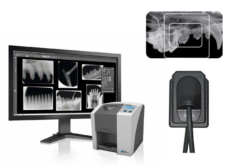 Digital Radiography Teeth Choosing the Right Digital Dental Imaging System for Your Practice