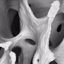 Veterinary dental VTS Fortigen™ Augmented Bone Graft (0.5, 1, & 2.5cc), which is real bone allograft with proprietary surface modification.