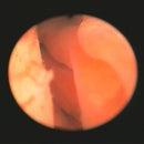 Veterinary dental Serona Animal Health Arthroscopy/Laparoscopy Set PS1000-20, with a 2.7mm 30 arthroscope, 9 Fr single stopcock, & more.