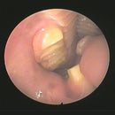 Veterinary dental Serona Animal Health Arthroscopy/Laparoscopy Set PS1000-20, with a 2.7mm 30 arthroscope, 9 Fr single stopcock, & more.