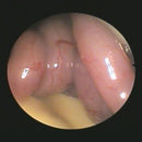 Veterinary dental Serona Animal Health Arthroscopy/Laparoscopy Set PS1000-20, with a 2.7mm 30 arthroscope, 9 Fr single stopcock, & more.