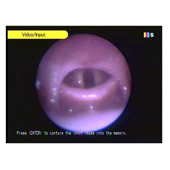 Veterinary dental semi-flexible micro-endoscope. This endoscope has a 1.9 mm O.D., 10,000-fiber image bundle, portable LED light source, ACMI-Storz®-Wolf lightpost, is compatible with most cameras, and is completely immersible.