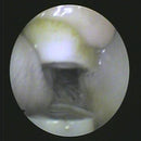 Shop online for the veterinary dental otoscope/endoscope. This is an MDS multi-use diagnostic endoscope that can be used as a high-resolution otoscope.