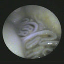 Shop online for the veterinary dental otoscope/endoscope. This is an MDS multi-use diagnostic endoscope that can be used as a high-resolution otoscope.