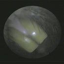 Shop online for the veterinary dental otoscope/endoscope. This is an MDS multi-use diagnostic endoscope that can be used as a high-resolution otoscope.