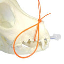 iM3 Anesthesia Tube Ties